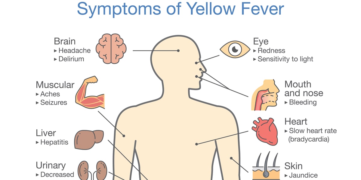 Early_Signs_Symptoms_of_Yellow_Fever
