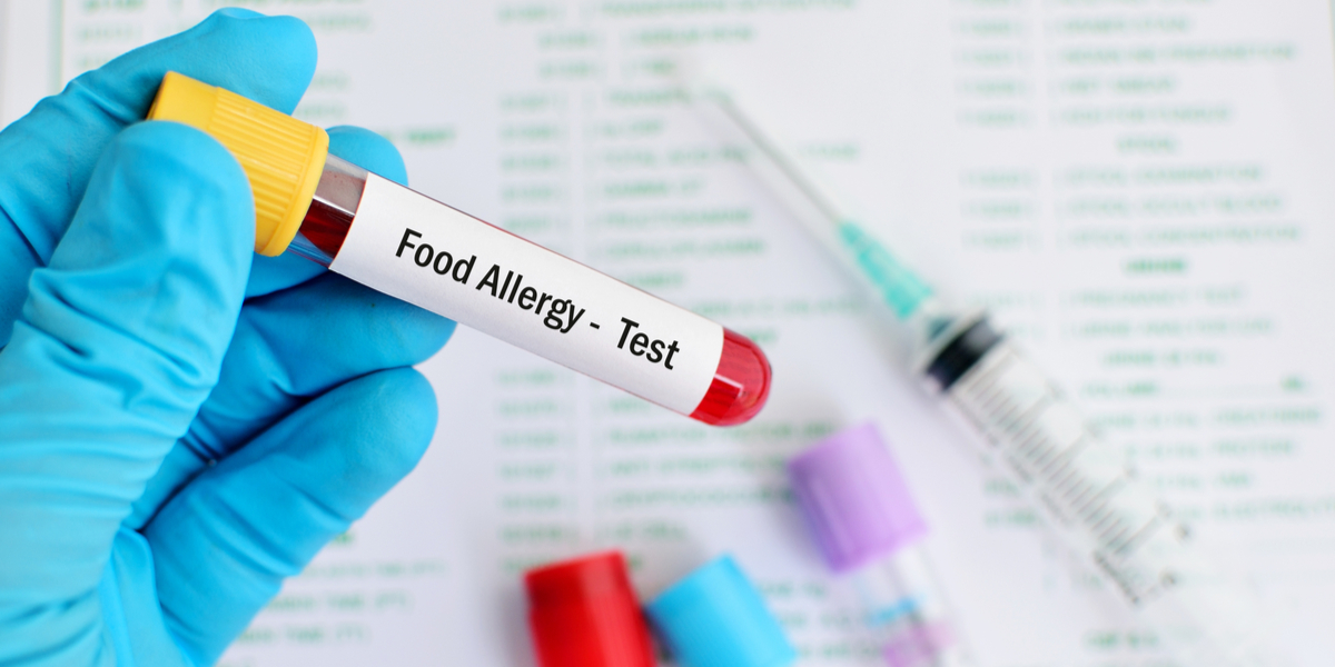 Food Allergy Test