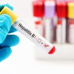 Hepatitis B