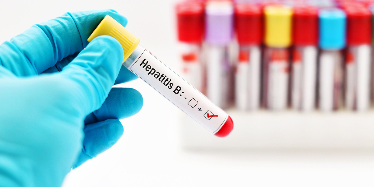 Hepatitis B