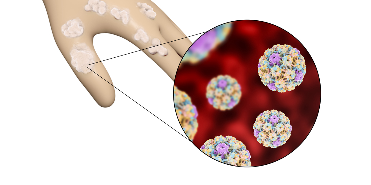 Human_Papillomavirus