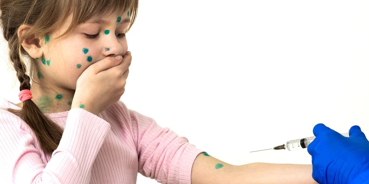 Should the Chickenpox Vaccine Be Offered to All Children