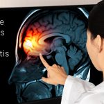 Signs of meningitis and treatment options