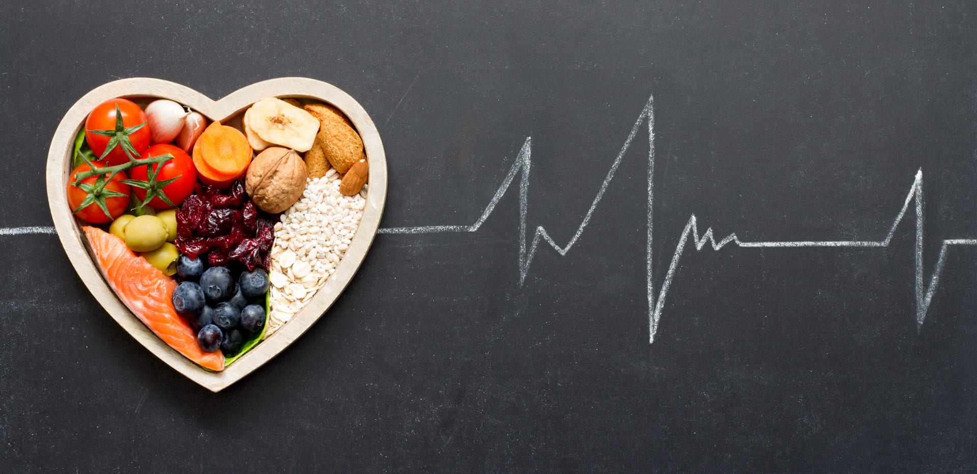 Touchwood Pharmacy Private Cholesterol Blood Test