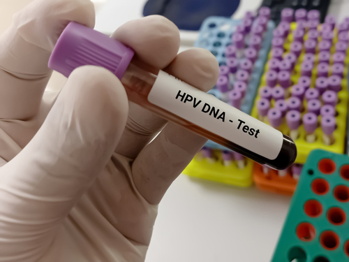 Test,Tube,With,Blood,Sample,For,Hpv,Dna,Test,,Human