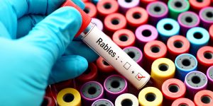 Rabies Vaccine - Touchwood Pharmacy