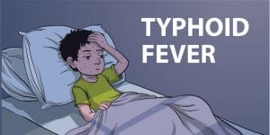 Typhoid-fever
