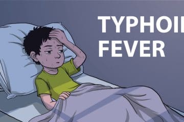 Typhoid fever - Touchwood Pharmacy