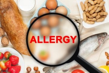 Food Allergy Testing - Touchwood Pharmacy