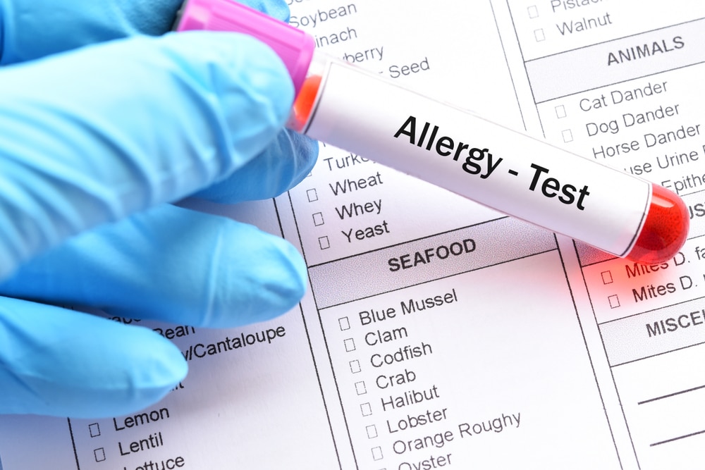 Allergy Testing - Touchwood Pharmacy