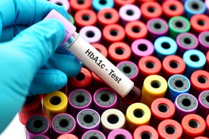 Analysing Diabetes Levels from Haemoglobin A1C Blood Test