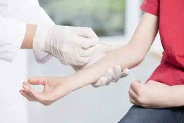 allergy testing
