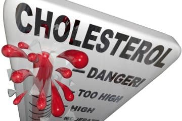private cholesterol blood tests