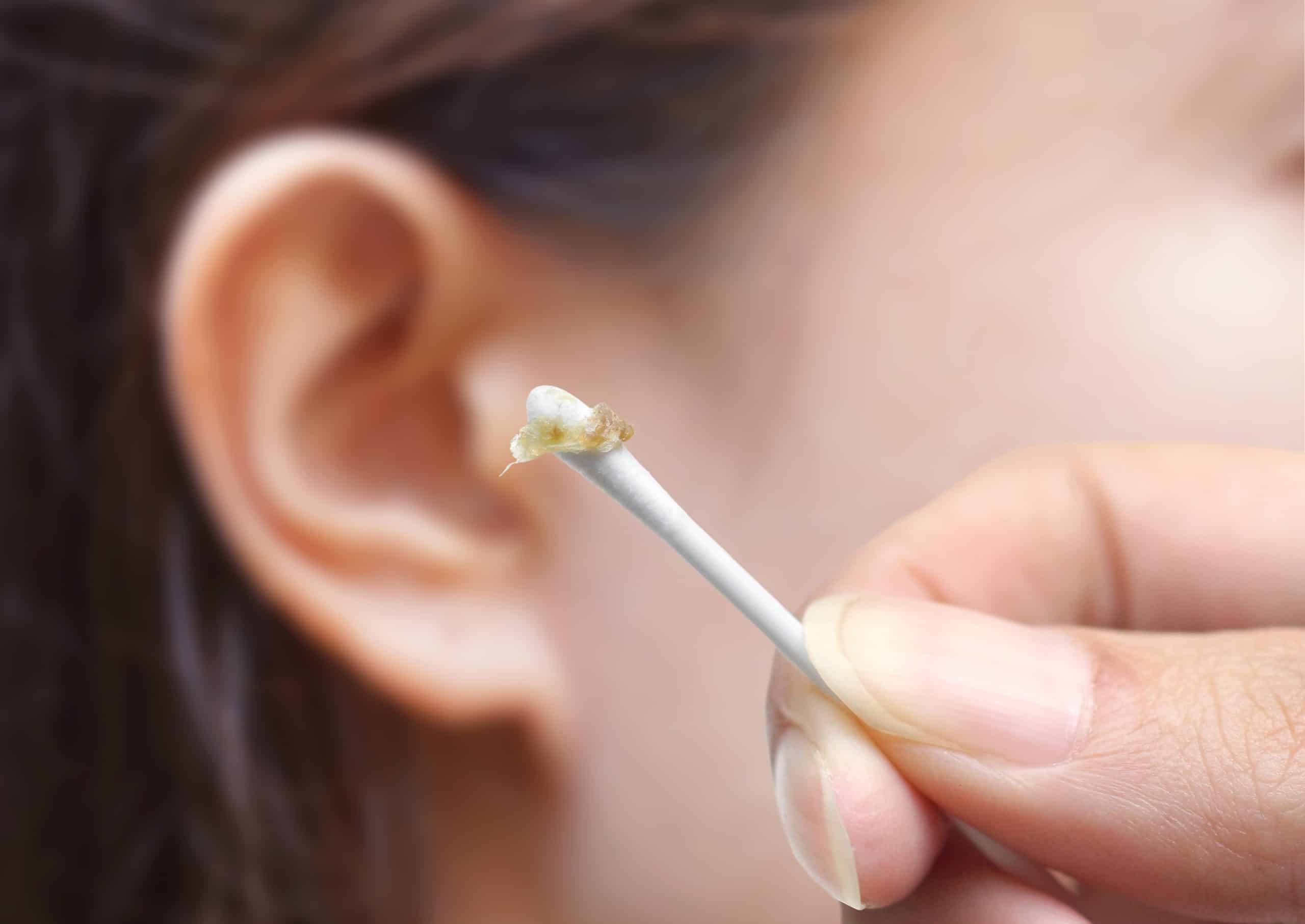 Can ear wax removal cause bleeding?