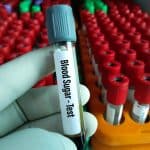 Blood tests for diabetes hba1c fasting glucose ogtt