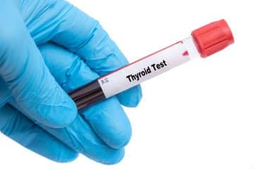 Thyroid Blood Test