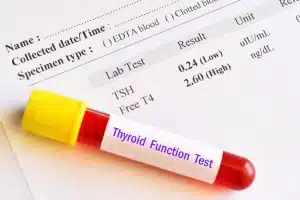 thyroid blood tests in Lichfield