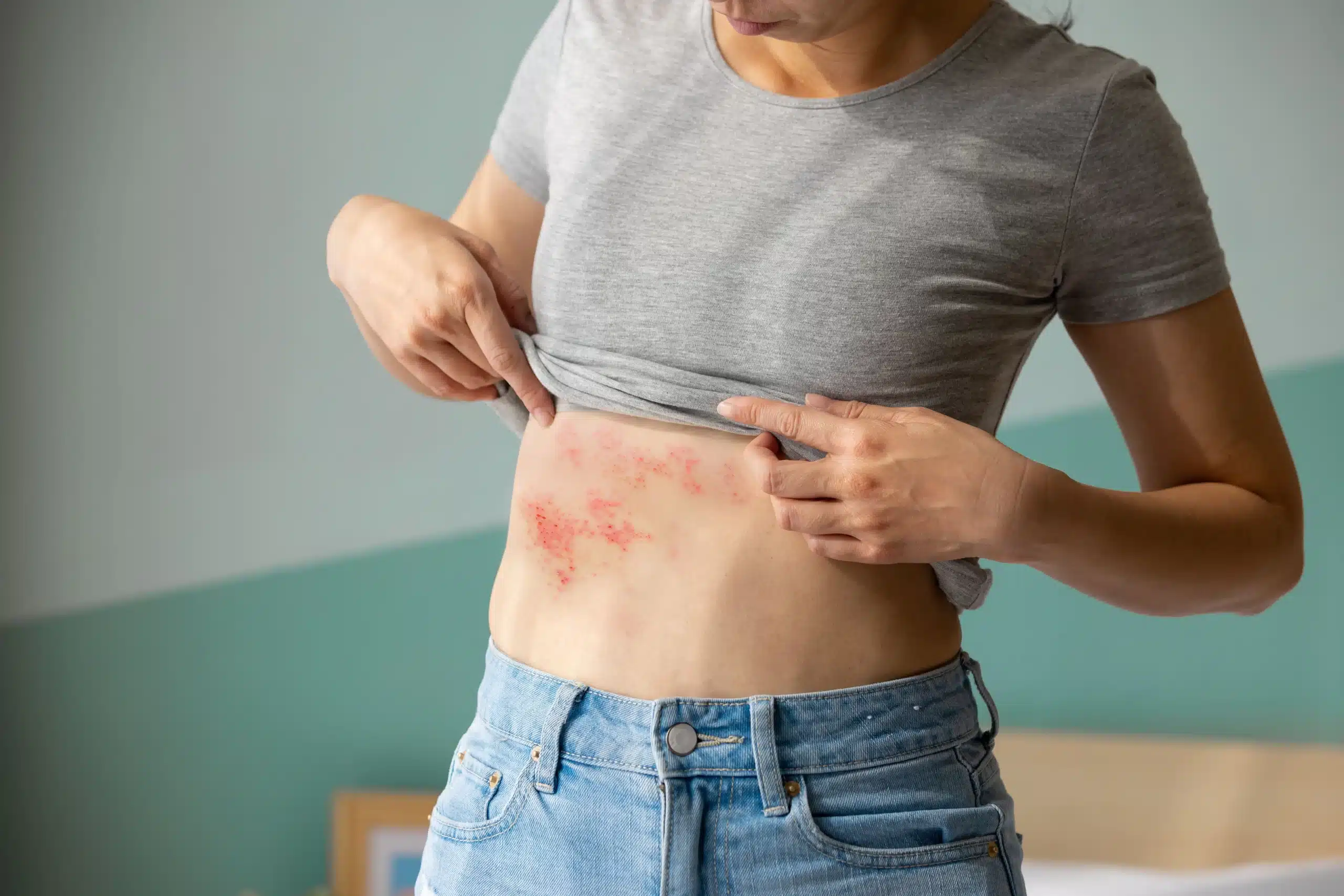 What-are-the-warning-signs-of-shingles