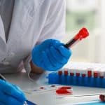 Information on private blood tests & their importance healthcare