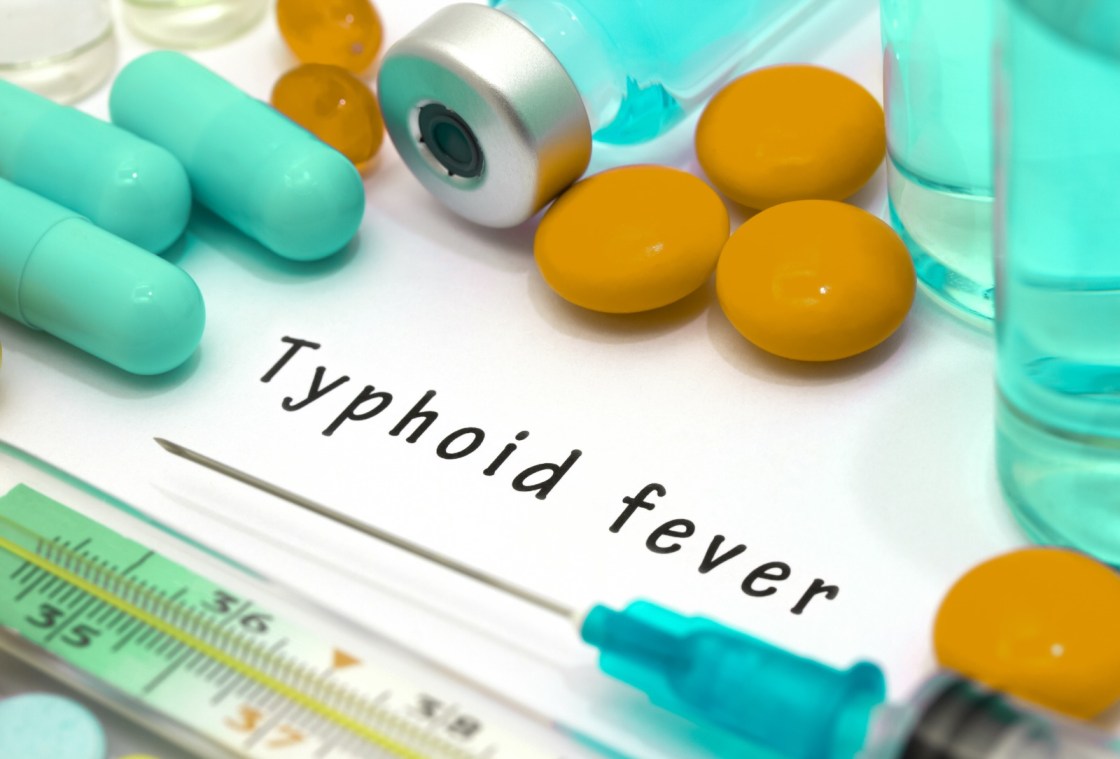 Preventing-typhoid-transmission-through-effective-strategies-and-measures