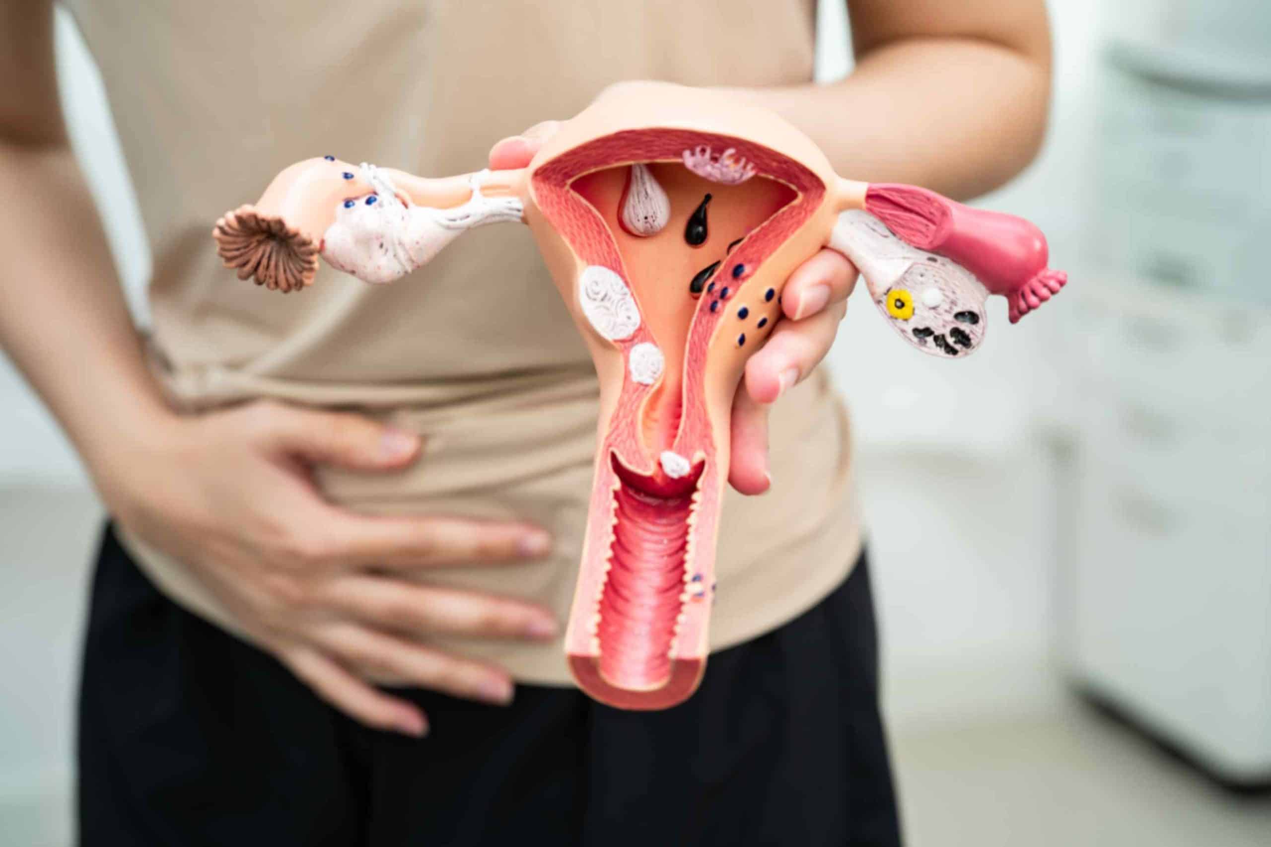 Can-cervical-cancer-occur-without-hpv-infection