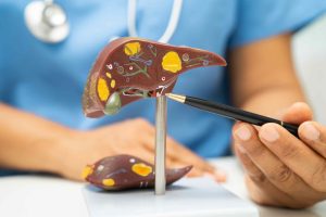 doctor showing liver model for hepatitis a and b treatment