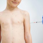 can adults get the chickenpox vaccine privately and should they