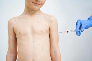 can adults get the chickenpox vaccine privately and should they